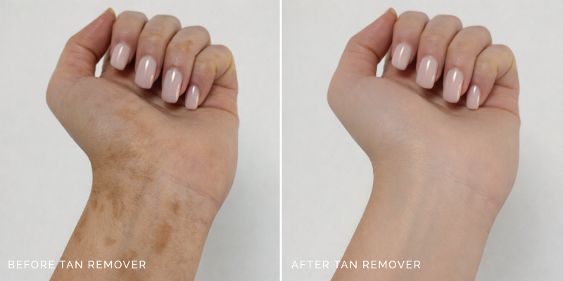 How to Remove Fake Tan from Hands, Fix Dark Palms, Knuckles and Streak