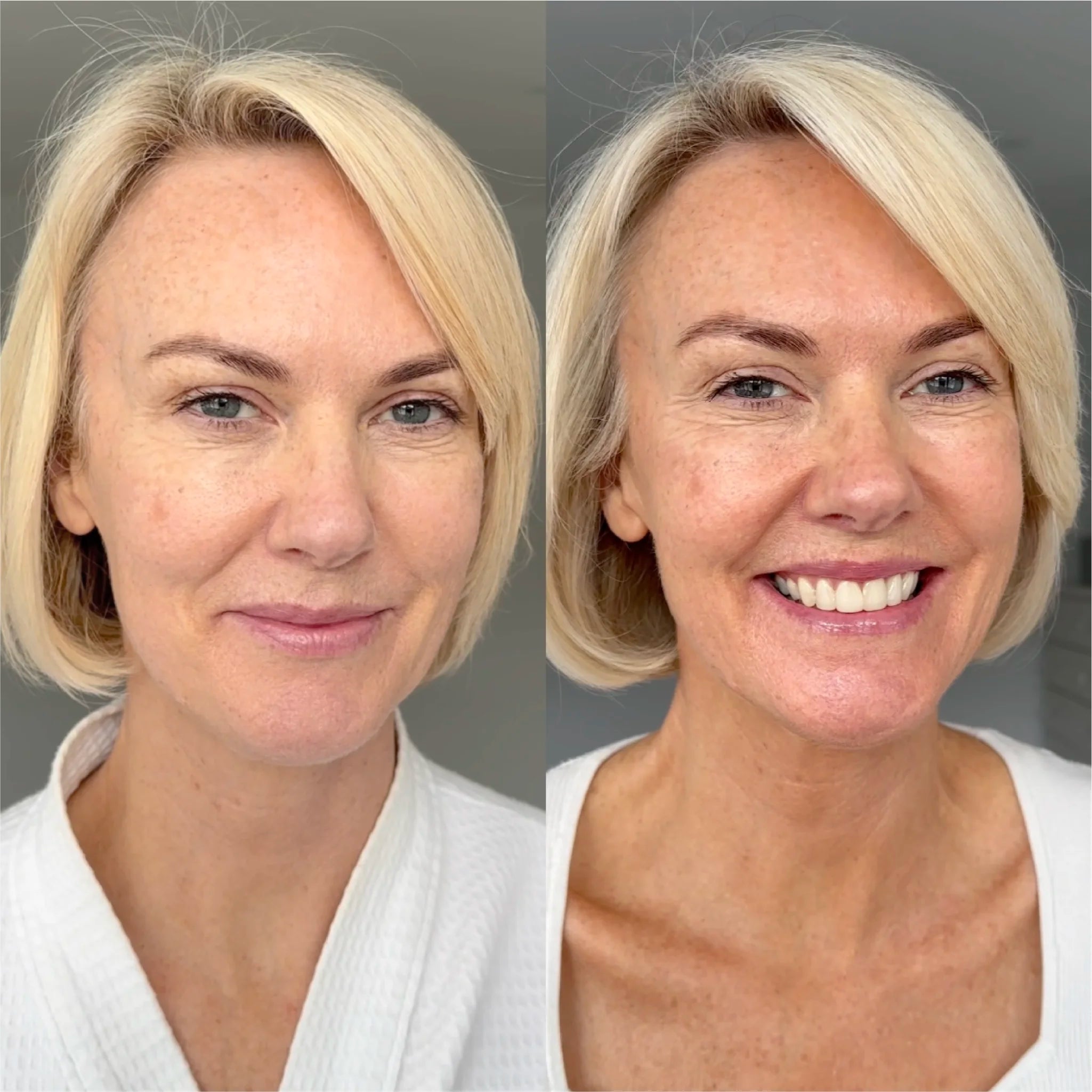 Before & After Sienna X Self Tan Concentrated Serum Drops