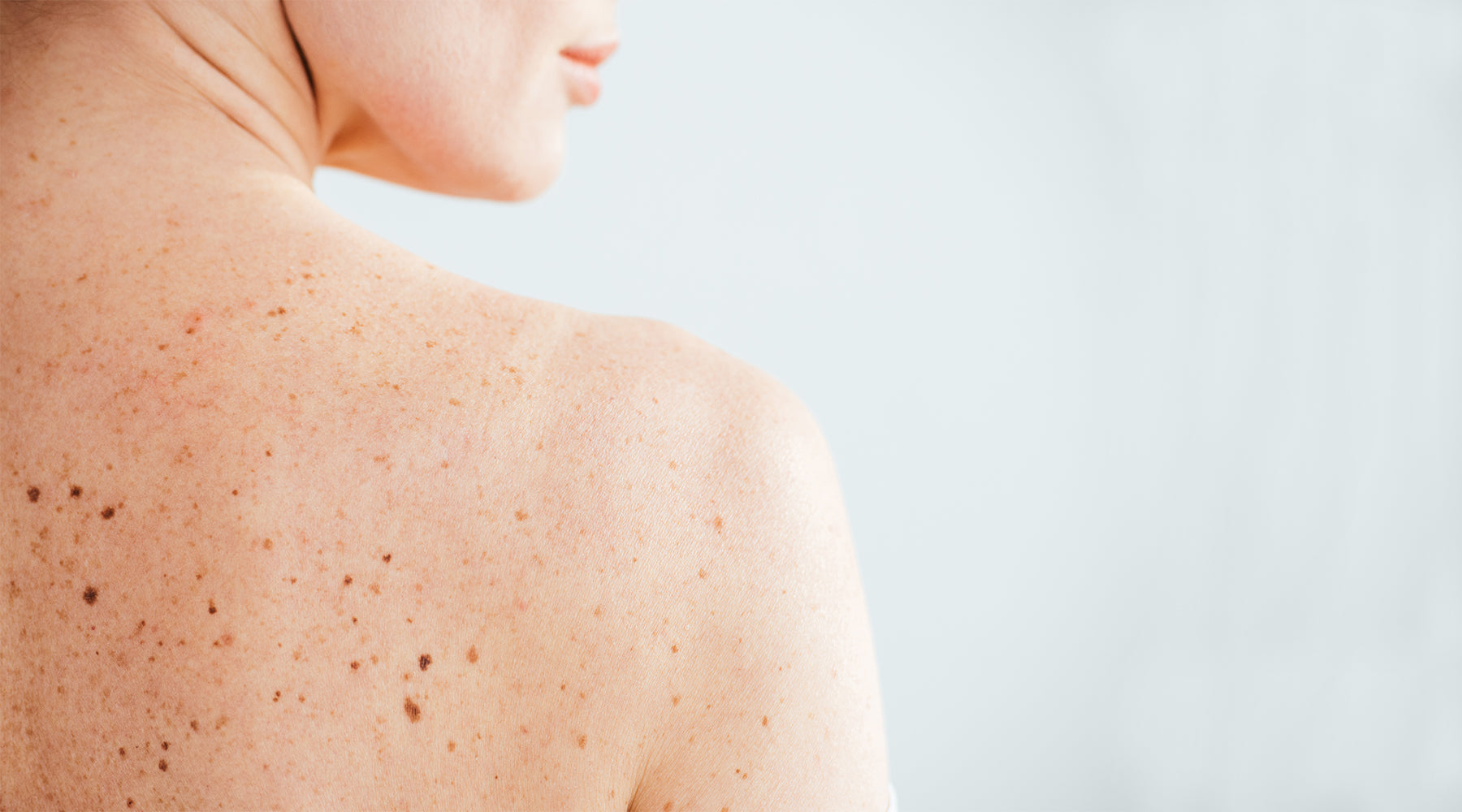 Skin Cancer Awareness Month